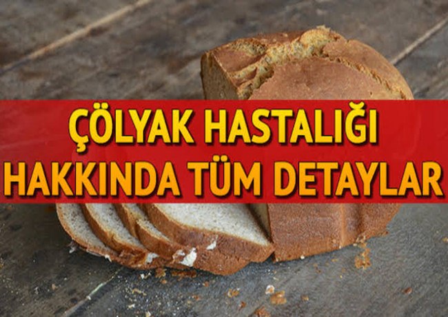 Aksaray'da Çölyak Hastaları dernekleşiyor 