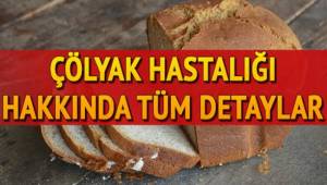 Aksaray'da Çölyak Hastaları dernekleşiyor 